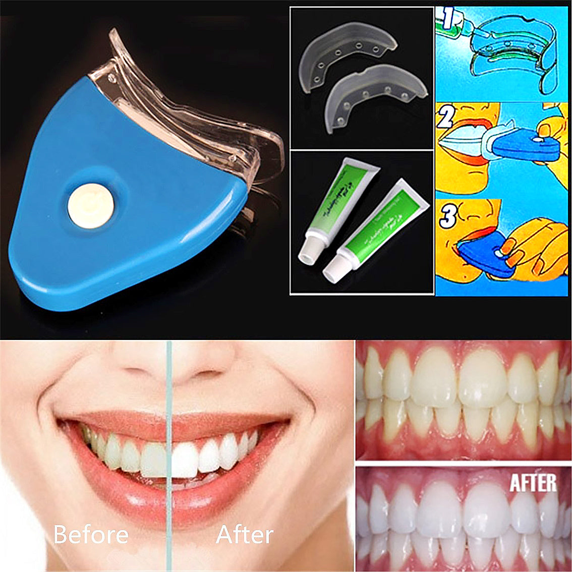 Oral Gel Teeth Whitening System with LED Light