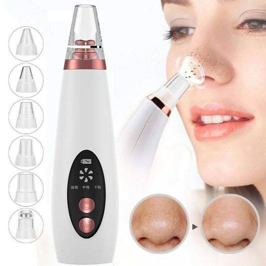 Microcrystalline Blackhead Pore Vacuum Cleaner